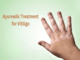 vitiligo treatment in Ayurveda